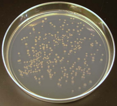 Размножение бактерий на плотной питательной среде.