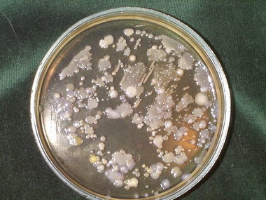 Бактерии в жидкой среде.